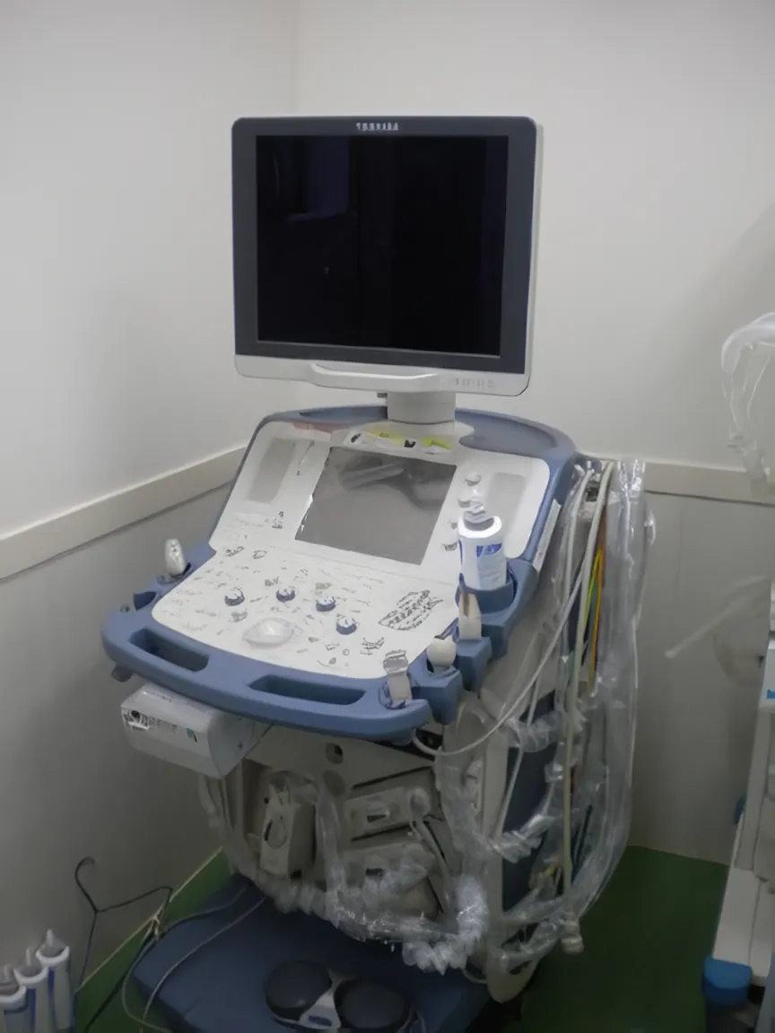 超音波診断装置