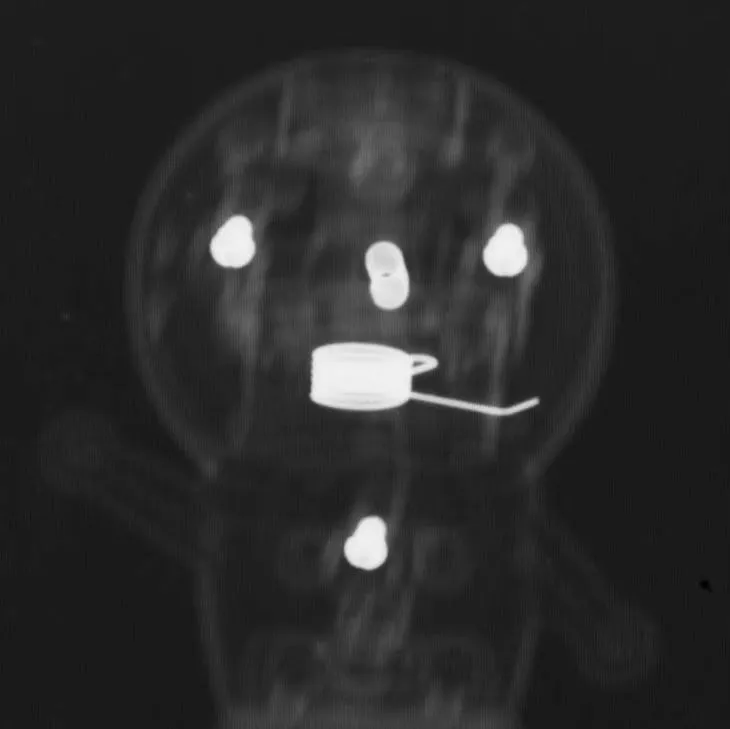 【異物】ドラえもんのレントゲン【食べた場合】