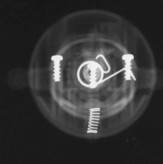 【異物】ドラえもんのレントゲン【食べた場合】